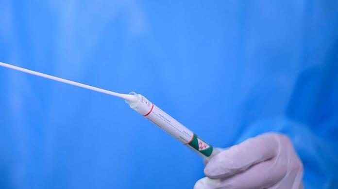 Ein Arzt hält einen Coronavirus-Test in den Händen. (Symbolbild)