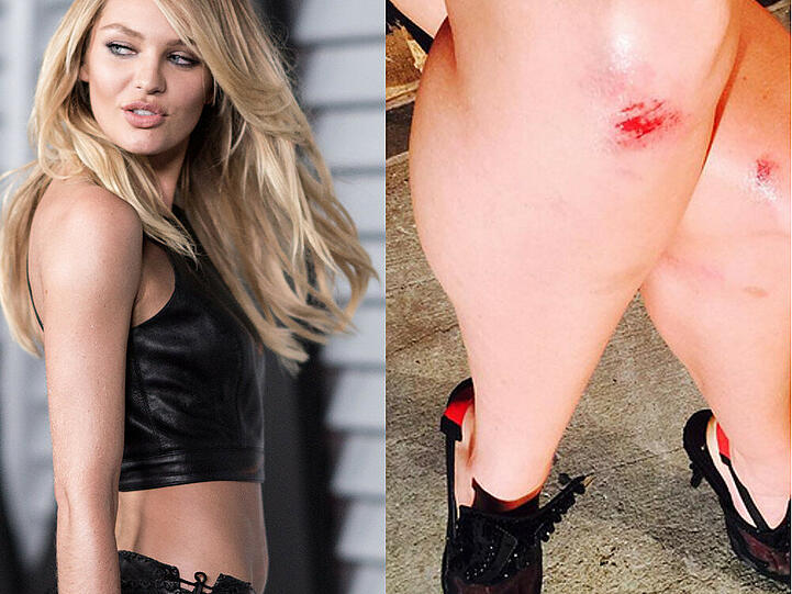 Candice Swanepoel: Kleine Kratzer nach dem Sturz auf der Fashion-Show