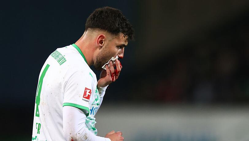 Maximilian Bauer blutet aus der Nase.