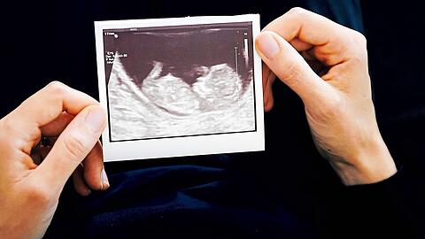 Schätzungsweise erleidet jede dritte Frau in Deutschland eine Fehlgeburt.