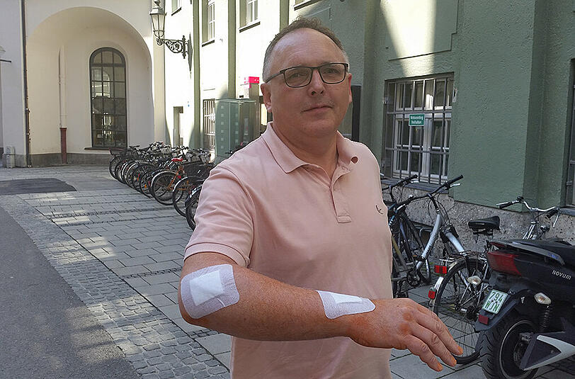 Erwin Gorny zeigt seine Verletzungen nach dem Radlunfall.