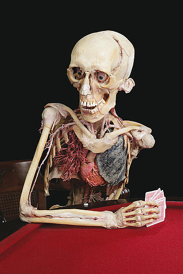 Ab April 2014 im Olympiapark: Die faszinierenden Plastinate von Gunter von Hagens