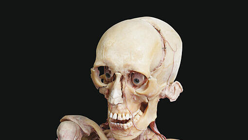 Ab April 2014 im Olympiapark: Die faszinierenden Plastinate von Gunter von Hagens Ab April 2014 im Olympiapark: Die faszinierenden Plastinate von Gunter von Hagens