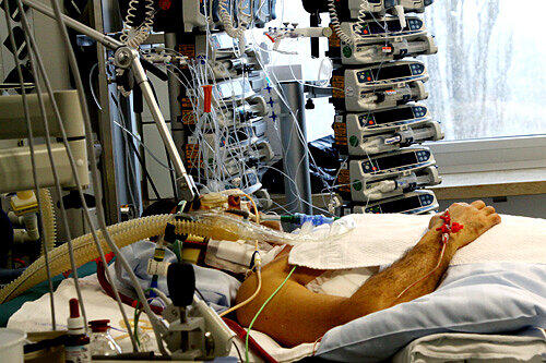 Beatmung per Herz-Lungen-Maschine: Ein Patient auf der Intensivstation des Uniklinikums Großhadern.