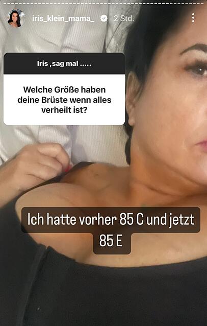 Iris Klein zeigt sich nach der Schönheits-OP und verrät, wie groß ihre Brüste geworden sind.