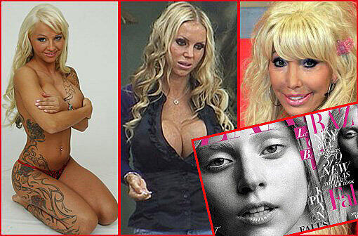 Lady Gaga hat sich jüngst ganz natürlich ohne Make Up gezeigt. Das ist aber eher ein Einzelfall. Viele Stars schummeln gerne beim Erscheinungsbild und lassen den den Schönheits-Doc an sich herumschrauben. Gerüchte, Tatsachen, falsche Fakten: Bei welchen Promis nicht alles echt ist, sehen Sie in unserer großen Bilderstrecke.