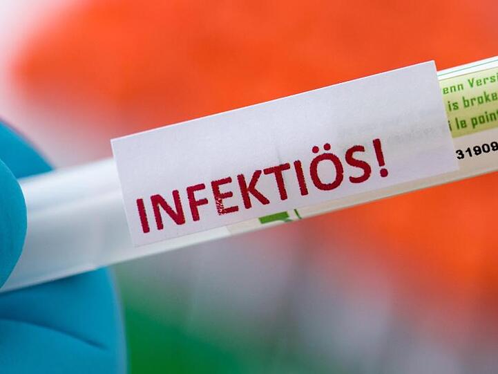 Eine Probe für ein Corona-Test in einem Diagnostik-Labor. Noch ist unklar, wie hoch die Zahl der Infizierten ist.