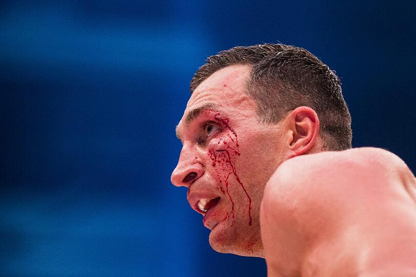2015: Wladimir Klitschko bei seiner Niederlage gegen Tyson Fury.