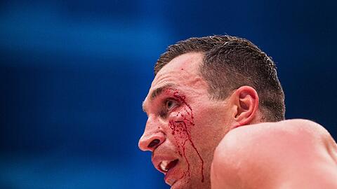 2015: Wladimir Klitschko bei seiner Niederlage gegen Tyson Fury.