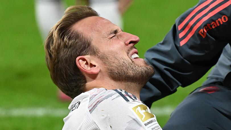 Stürmer-Star Harry Kane hatte beim Spiel gegen Eintracht Frankfurt (3:0) einen Schlag auf den rechten Knöchel bekommen.