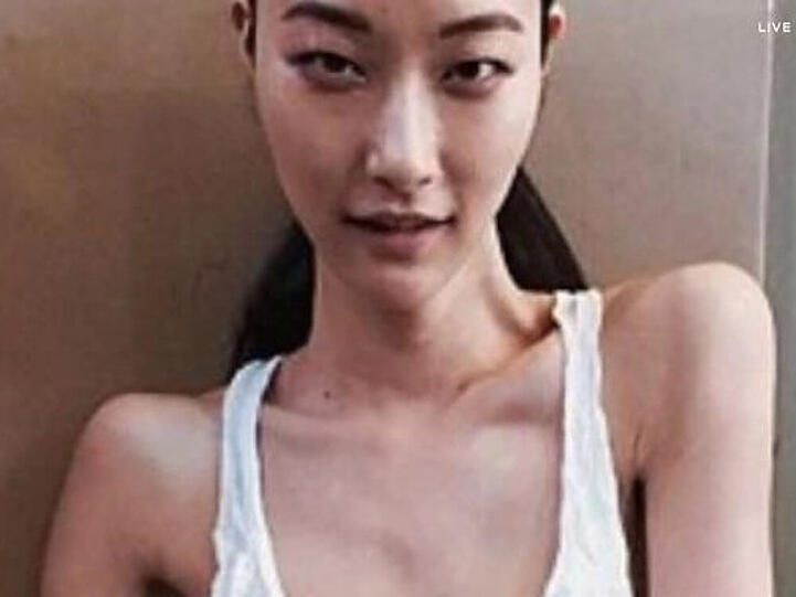 Stella McCartney postete ein Bild eines Mager-Models und löste damit einen Shitstorm aus