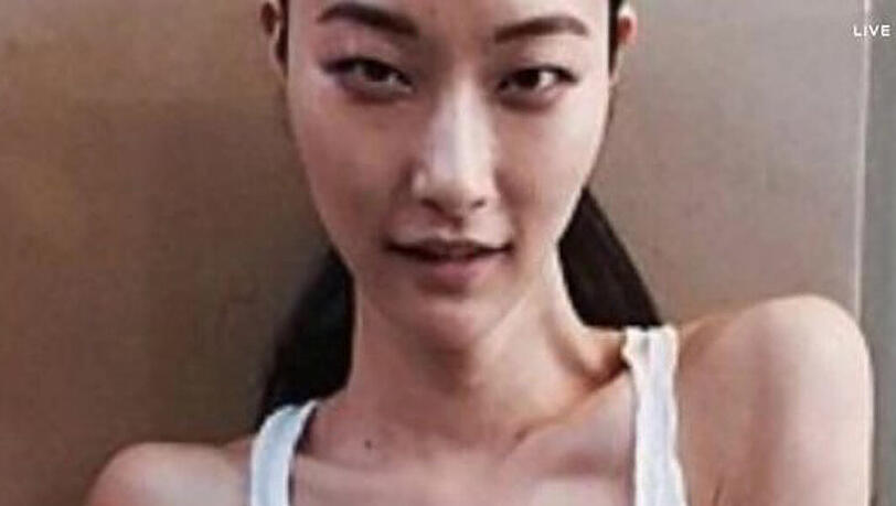 Stella McCartney postete ein Bild eines Mager-Models und löste damit einen Shitstorm aus Stella McCartney postete ein Bild eines Mager-Models und löste damit einen Shitstorm aus