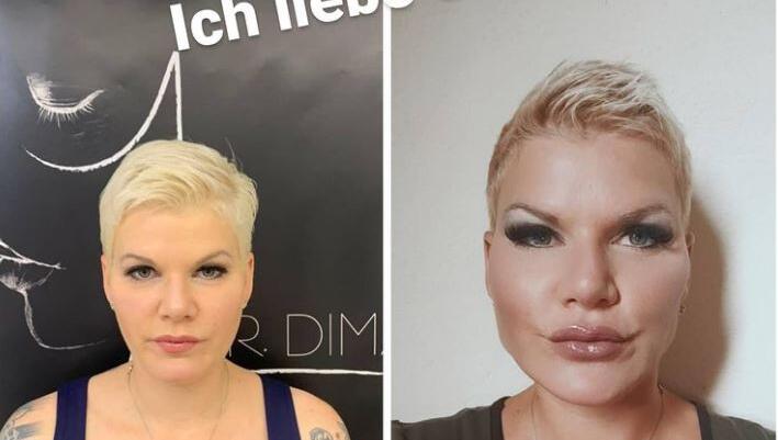 Vorher-Nachher-Vergleich: Melanie Müller ist begeistert von ihrem neuen Aussehen. Vorher-Nachher-Vergleich: Melanie Müller ist begeistert von ihrem neuen Aussehen.