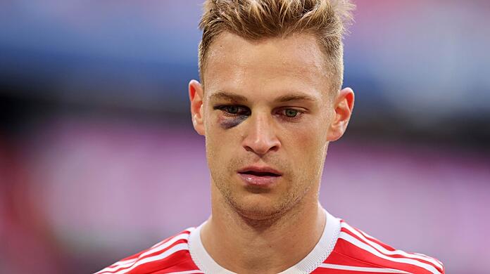 "Mittlerweile habe ich bei ihm das Gefühl, dass er glänzen will und dass man ihn aufgrund seines Status nicht mehr angreifen, geschweige denn berühren darf", sagt Markus Babbel über Joshua Kimmich.