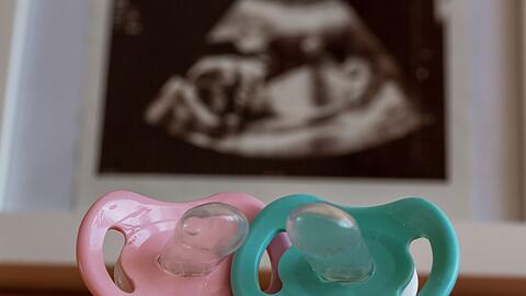 Wie ein Kind sein wird, wei&szlig; man vor der Geburt nicht. Verbinden werdende Eltern deshalb so viel mit dem Geschlecht?