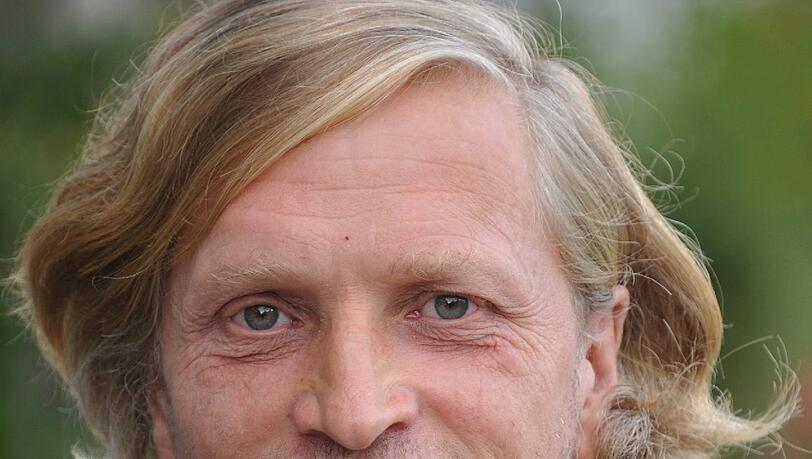 Ziemlich lückenhaft: das gebiss von Udo Biesewski vor der OP. Ziemlich lückenhaft: das gebiss von Udo Biesewski vor der OP.