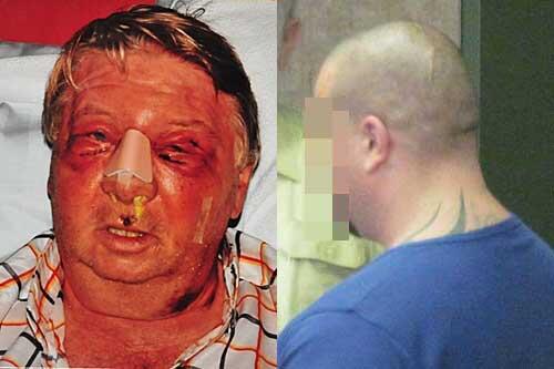 Links: Gesicht zertrümmert: So sah Paul T. nach der Attacke aus; rechts: chlug zu: Kraftfahrer Günther E. (37).