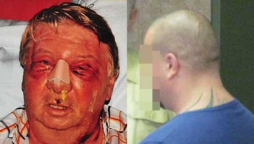 Links: Gesicht zertrümmert: So sah Paul T. nach der Attacke aus; rechts: chlug zu: Kraftfahrer Günther E. (37). Links: Gesicht zertrümmert: So sah Paul T. nach der Attacke aus; rechts: chlug zu: Kraftfahrer Günther E. (37).
