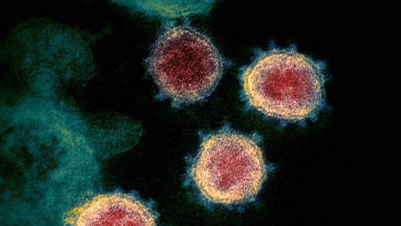 Elektronenmikroskopische Aufnahme zeigt das Virus, das COVID-19 verursacht. Foto: Uncredited/NIAID-RML/via Ap/dpa/Archivbild Elektronenmikroskopische Aufnahme zeigt das Virus, das COVID-19 verursacht. Foto: Uncredited/NIAID-RML/via Ap/dpa/Archivbild