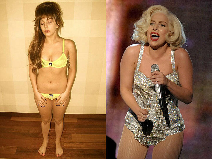 Lady Gaga litt mit 15 Jahren an Magersucht - heute hat sie die Krankheit im Griff