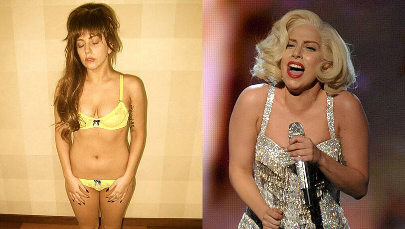 Lady Gaga litt mit 15 Jahren an Magersucht - heute hat sie die Krankheit im Griff Lady Gaga litt mit 15 Jahren an Magersucht - heute hat sie die Krankheit im Griff