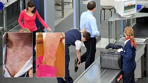 Sicherheitsmitarbeiter bei der Kontrolle am Flughafen: Ehemalige Beschäftigte klagen über Gesundheitsschäden.