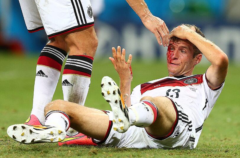 Der Bayern-Stürmer ist überrascht von dem vielen Blut...