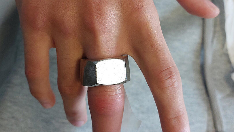 Ein 15-Jähriger wollte sich Körperschmuck selbst herstellen und steckte sich dazu eine Schraubenmutter auf den Mittelfinger der rechten Hand.