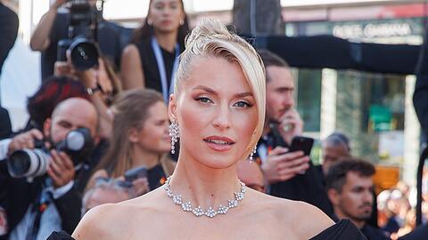 Lena Gercke muss derzeit wortwörtlich kürzer treten. Bedingt durch eine Fußverletzung ist sie stark eingeschränkt.