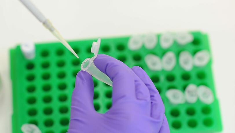 Die DNA-Analyse war einst ein Durchbruch in der Ermittlungsgeschichte. Jetzt wurde mit der Methode ein Einbrecher ermittelt. Die DNA-Analyse war einst ein Durchbruch in der Ermittlungsgeschichte. Jetzt wurde mit der Methode ein Einbrecher ermittelt.