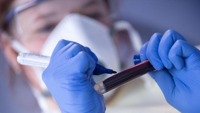 Innerhalb von 24 Stunden haben die Gesundheitsämter in Deutschland dem Robert Koch-Institut (RKI) 318 neue Infektionen mit dem Coronavirus gemeldet. Innerhalb von 24 Stunden haben die Gesundheitsämter in Deutschland dem Robert Koch-Institut (RKI) 318 neue Infektionen mit dem Coronavirus gemeldet.