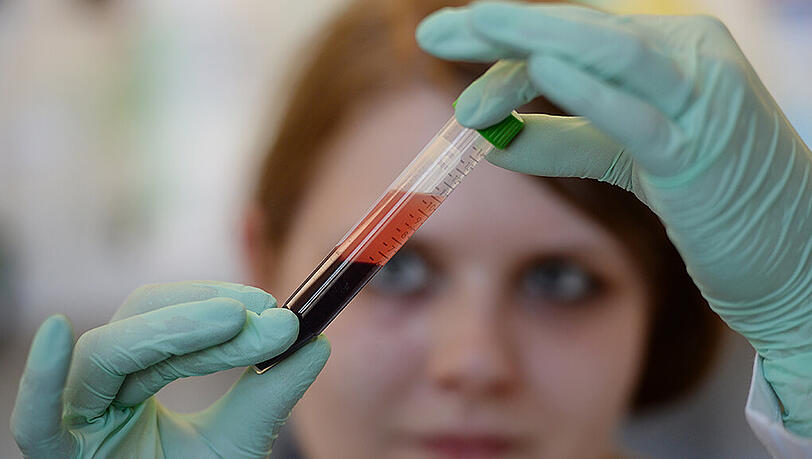 Bluttest in einem Transfusionszentrum. Foto: Patrick Seeger Bluttest in einem Transfusionszentrum. Foto: Patrick Seeger