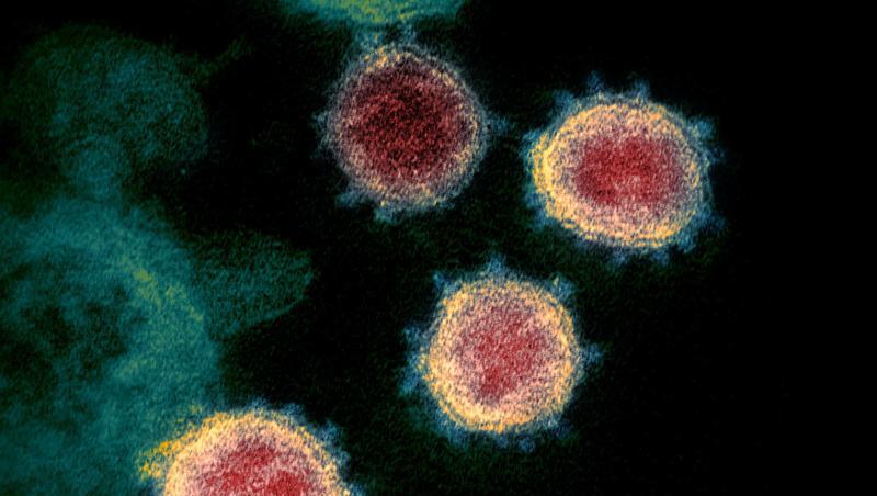 Elektronenmikroskopische Aufnahme, die vom U.S. National Institutes of Health im Februar 2020 zur Verfügung gestellt wurde, zeigt das Virus, das COVID-19 verursacht. Foto: Uncredited/NIAID-RML/via Ap/dpa/Archivbild Elektronenmikroskopische Aufnahme, die vom U.S. National Institutes of Health im Februar 2020 zur Verfügung gestellt wurde, zeigt das Virus, das COVID-19 verursacht. Foto: Uncredited/NIAID-RML/via Ap/dpa/Archivbild