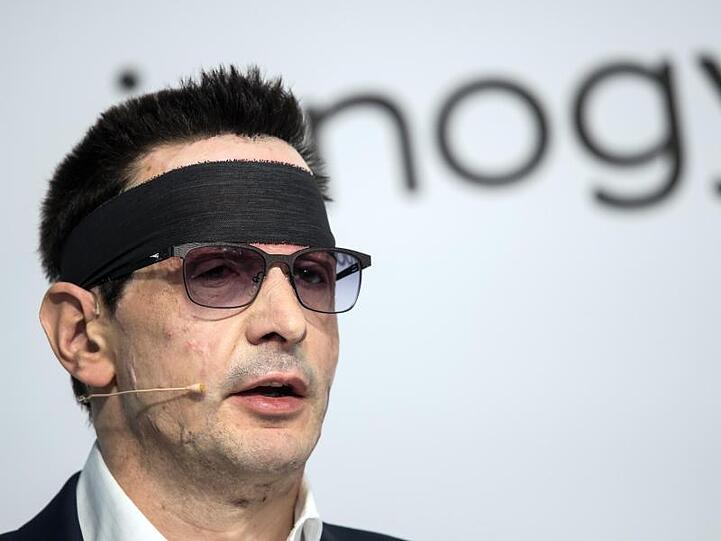 Vom Anschlag gezeichnet: Bernhard Günther, Finanzvorstand des Ökostrom-Konzerns Innogy, während der Bilanz-Pressekonferenz.