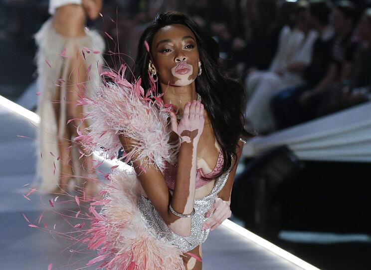 Topmodel Winnie Harlow