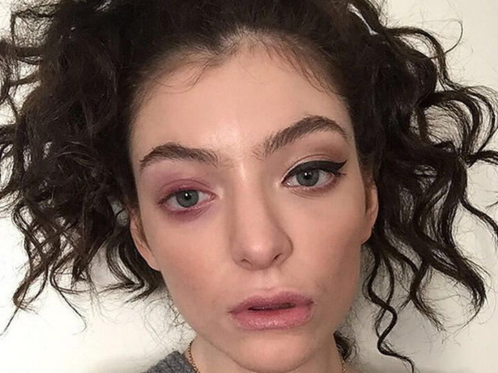 Lorde leidet an einem kranken Auge