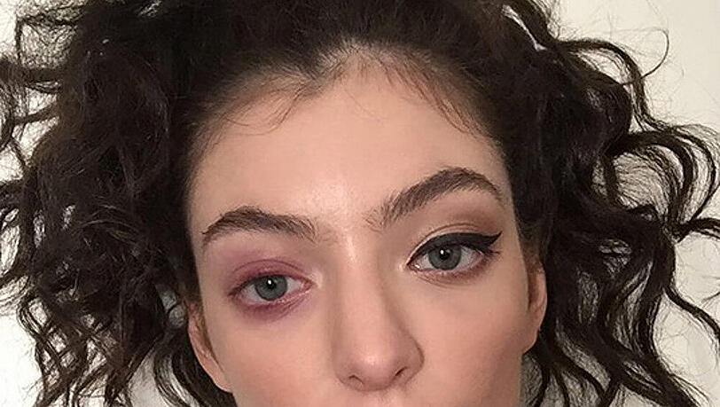 Lorde leidet an einem kranken Auge Lorde leidet an einem kranken Auge