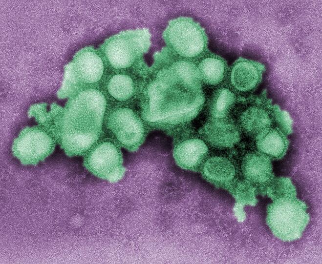 Es ist an allem Schuld: Eine Aufnahme des H1N1-Virus, das sich zur Zeit bei uns breitmacht und die Grippe auslöst.