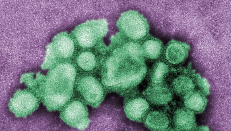 Es ist an allem Schuld: Eine Aufnahme des H1N1-Virus, das sich zur Zeit bei uns breitmacht und die Grippe auslöst. Es ist an allem Schuld: Eine Aufnahme des H1N1-Virus, das sich zur Zeit bei uns breitmacht und die Grippe auslöst.