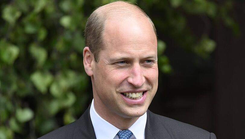 Prinz William hat an der Schläfe eine kleine Narbe, die aus seiner Kindheit stammt.