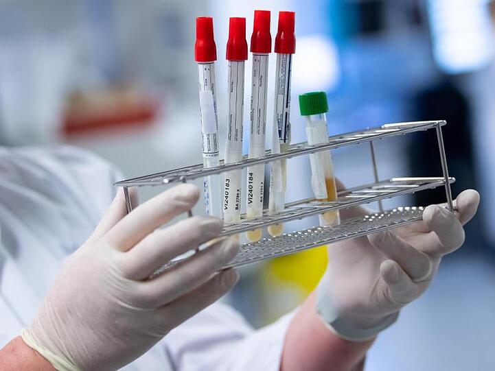 Eine Laborantin bereitet Proben für Corona-Tests für die weitere Analyse vor. Foto: Sven Hoppe/dpa/Archiv/Symbolbild