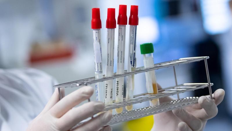 Eine Laborantin bereitet Proben für Corona-Tests für die weitere Analyse vor. Foto: Sven Hoppe/dpa/Archiv/Symbolbild Eine Laborantin bereitet Proben für Corona-Tests für die weitere Analyse vor. Foto: Sven Hoppe/dpa/Archiv/Symbolbild