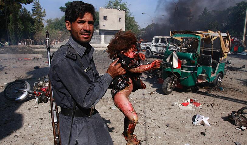 Dieses kleine Kind hatte Glück im Unglück: Es ist noch am Leben. Doch durch die Explosion hat es bei dem Attentat schwere Verletzungen erlitten.