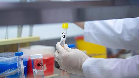 Eine Ärztin zeigt in einem Labor einen Test für das Coronavirus. Foto: Sebastian Gollnow/dpa/Symbolbild