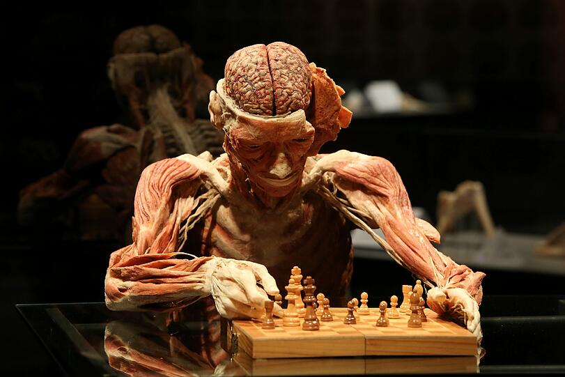 Zum Schach spielen braucht man Hirn. Deshalb ist das Denk-Organ bei diesem Präparat prominent freigelegt.
