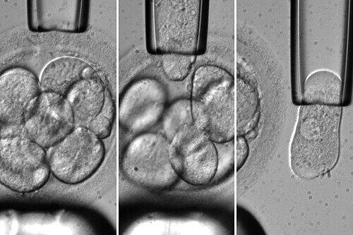 Um den richtigen Embryo auszuwählen, müssen sie untersucht werden