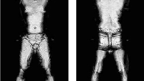 Diese Bilder hatten die Öffentlichkeit nach den Nacktscanner plänen aufgeschreckt Diese Bilder hatten die Öffentlichkeit nach den Nacktscanner plänen aufgeschreckt