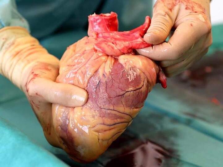 Ein Transplantationsmediziner hält ein Herz in den Händen. Foto: Bernd Wüstneck/Archiv