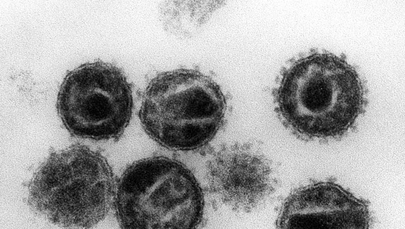 HIV-Viren unter einem Elektronenmikroskop. HIV-Viren unter einem Elektronenmikroskop.