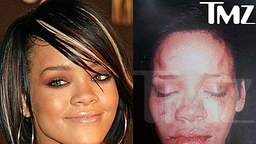 Ein Bild, das schockiert: Die von ihrem Freund Chris Brown misshandelte Rihanna. Ein Bild, das schockiert: Die von ihrem Freund Chris Brown misshandelte Rihanna.